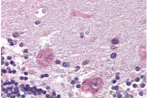 Human Brain, Cerebellum (formalin-fixed, paraffin-embedded) stained with PPP2R3A antibody ABIN337311 at 5 ug/ml followed by biotinylated anti-goat IgG secondary antibody ABIN481715, alkaline phosphatase-streptavidin and chromogen. (PPP2R3A anticorps  (AA 1073-1085))