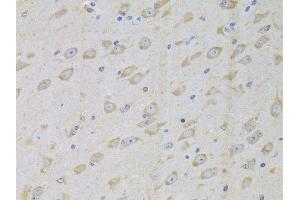 Immunohistochemistry of paraffin-embedded mouse brain using GARS antibody.