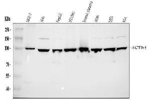 Western blot analysis of Alpha Actinin 4 using anti-Alpha Actinin 4 antibody (ABIN4886421). (alpha Actinin 4 anticorps  (AA 561-661))
