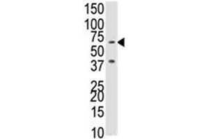 Western blot analysis of BMPR1B antibody and NCI-H460 cell lysate.