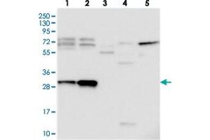 Western blot analysis of Lane 1: RT-4, Lane 2: U-251 MG, Lane 3: Human Plasma, Lane 4: Liver, Lane 5: Tonsil with C15orf23 polyclonal antibody  at 1:250-1:500 dilution.