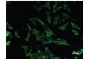 Immunostaining analysis in HeLa cells.