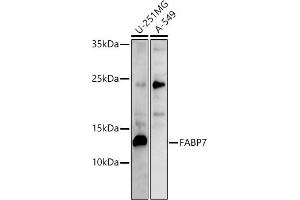 Western blot analysis of extracts of various cell lines, using F antibody (ABIN6129530, ABIN6140428, ABIN6140430 and ABIN6215290) at 1:500 dilution.