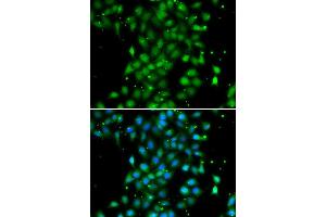 Immunofluorescence analysis of MCF7 cell using UBE2Z antibody. (UBE2Z anticorps)