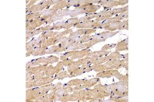 Immunohistochemistry of paraffin-embedded rat heart using PSEN2 antibody.