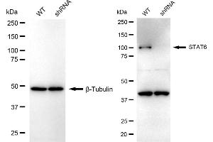 Western blotting analysis using STAT6 antibody (ABIN7800349).