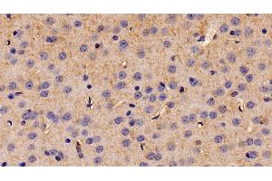 Detection of EIF2aK3 in Mouse Cerebrum Tissue using Polyclonal Antibody to Eukaryotic Translation Initiation Factor 2 Alpha Kinase 3 (EIF2aK3)