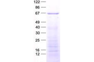 Validation with Western Blot (PIKFYVE Protein (His tag))