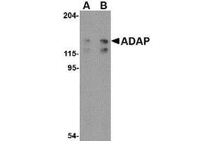 Western blot analysis of ADAP in K562 cell lysate with AP30019PU-N ADAP antibody at (A) 0. (FYB anticorps  (C-Term))