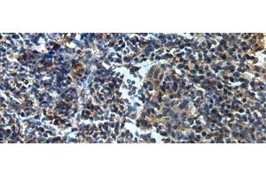 Immunohistochemistry of paraffin-embedded Human tonsil tissue using ATP1B2 Polyclonal Antibody at dilution of 1:25(x200) (ATP1B2 anticorps)