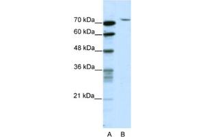 Western Blotting (WB) image for anti-TAF6 RNA Polymerase II, TATA Box Binding Protein (TBP)-Associated Factor, 80kDa (TAF6) antibody (ABIN2461761) (TAF6 anticorps)