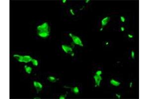 Immunofluorescence staining of human LNCaP cell colony with STEAP1 monoclonal antibody, clone J2D2 .