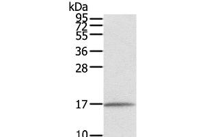 Western Blot analysis of Human normal liver tissue using EVA1A Polyclonal Antibody at dilution of 1:550 (TMEM166 anticorps)