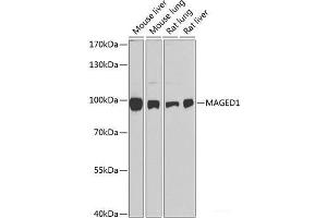 Western blot analysis of extracts of various cell lines using MAGED1 Polyclonal Antibody at dilution of 1:1000. (MAGED1 anticorps)