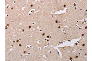 The image on the left is immunohistochemistry of paraffin-embedded Human brain tissue using ABIN7128323(AKAP8L Antibody) at dilution 1/20, on the right is treated with fusion protein. (AKAP8L anticorps)
