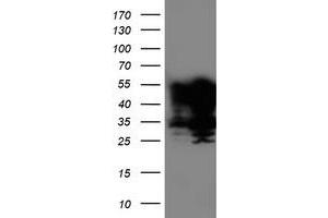 Western Blotting (WB) image for anti-T-Cell Acute Lymphocytic Leukemia 1 (TAL1) antibody (ABIN1501291) (TAL1 anticorps)