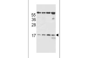 TCRB Antibody (Center) (ABIN656127 and ABIN2845468) western blot analysis in MDA-M,HE,Ramos,NCI- cell line lysates (35 μg/lane). (TCRb anticorps  (AA 67-94))