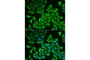 Immunofluorescence analysis of A549 cell using DTYMK antibody.