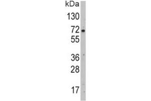 Western blot analysis of GLUT2 antibody and HepG2 lysate. (SLC2A2 anticorps  (AA 31-60))
