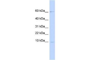 WB Suggested Anti-PI3 Antibody Titration:  0. (PI3 anticorps  (Middle Region))