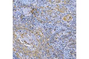 IHC analysis of GAPDH using anti-GAPDH antibody (ABIN5518757).