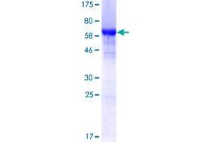 Image no. 1 for Heterogeneous Nuclear Ribonucleoprotein F (HNRNPF) (AA 1-415) protein (GST tag) (ABIN1306875)