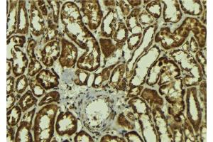 ABIN6278147 at 1/100 staining Mouse kidney tissue by IHC-P.
