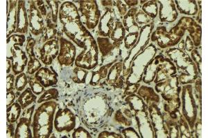 ABIN6278147 at 1/100 staining Mouse kidney tissue by IHC-P. (MAGEA1 anticorps  (N-Term))
