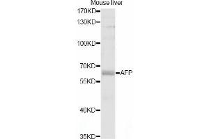 Western blot analysis of extracts of mouse liver, using AFP antibody (ABIN5997204) at 1/1000 dilution. (alpha Fetoprotein anticorps)