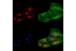 ABIN7094619 and ABIN7098669 staining  cells by IF/ICC. (PPP1R13L anticorps  (C-Term))