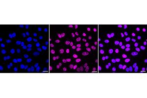 Immunocytochemical staining of HepG2 cells with METTL3 antibody (ABIN7799400), 1:1,000). (Recombinant METTL3 anticorps)