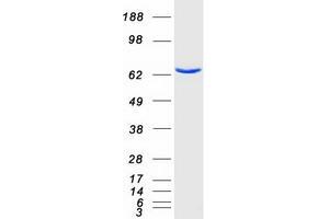 Validation with Western Blot