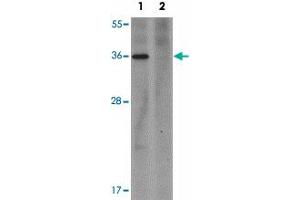 Western blot analysis of PLAC1 in human placenta tissue lysate with PLAC1 polyclonal antibody  at 1 ug/mL in (1) the absence and (2) the presence of blocking peptide. (PLAC1 anticorps  (C-Term))