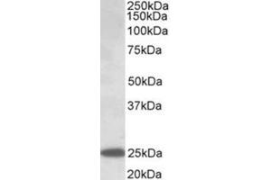 Western Blotting (WB) image for anti-Abhydrolase Domain Containing 14B (ABHD14B) (AA 188-200), (Internal Region) antibody (ABIN1105190) (ABHD14B anticorps  (Internal Region))
