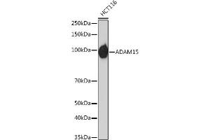ADAM15 anticorps