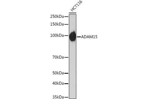 ADAM15 anticorps