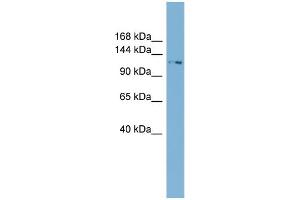 WB Suggested Anti-TTC17  Antibody Titration: 0. (TTC17 anticorps  (N-Term))