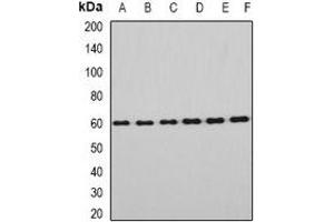 Western blot analysis of EYA3 expression in Hela (A), HT29 (B), mouse eye (C), mouse testis (D), rat brain (E), rat liver (F) whole cell lysates. (EYA3 anticorps)