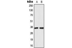 Western blot analysis of AKR1C1 expression in HeLa (A), HepG2 (B) whole cell lysates.