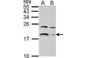 WB Image LC3B antibody detects LC3B protein by western blot analysis. (LC3B anticorps)