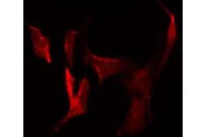 ABIN6278839 staining HuvEc by IF/ICC. (CDH26 anticorps  (N-Term))