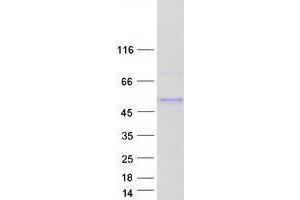 Validation with Western Blot