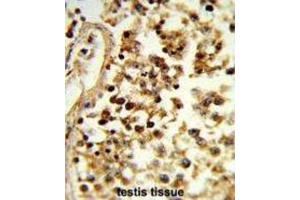 Immunohistochemistry (IHC) image for anti-Interleukin 31 (IL31) antibody (ABIN3004157)