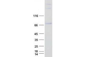 Validation with Western Blot