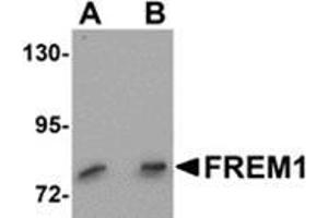 Western blot analysis of FREM1 in K562 cell lysate with FREM1 antibody at (A) 0. (FREM1 anticorps  (C-Term))