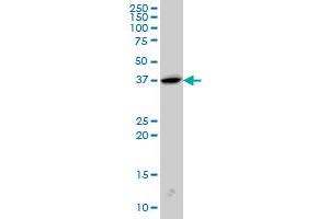 SH3GL2 monoclonal antibody (M01), clone 5A6 Western Blot analysis of SH3GL2 expression in PC-12 . (SH3G2 anticorps  (AA 64-124))