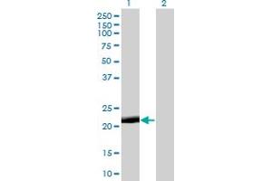 Western Blot analysis of PAGE4 expression in transfected 293T cell line by PAGE4 monoclonal antibody (M01), clone 7C3. (PAGE4 anticorps  (AA 1-102))