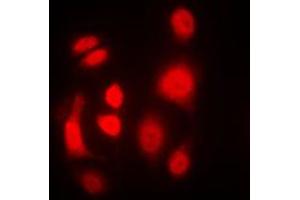 Immunofluorescent analysis of PKR staining in MCF7 cells. (EIF2AK2 anticorps  (C-Term))