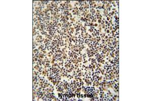 DENND1B antibody immunohistochemistry analysis in formalin fixed and paraffin embedded human lymph tissue followed by peroxidase conjugation of the secondary antibody and DAB staining. (DENND1B anticorps  (N-Term))