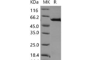 Western Blotting (WB) image for C-Mer Proto-Oncogene Tyrosine Kinase (MERTK) (Active) protein (GST tag,His tag) (ABIN7320009)